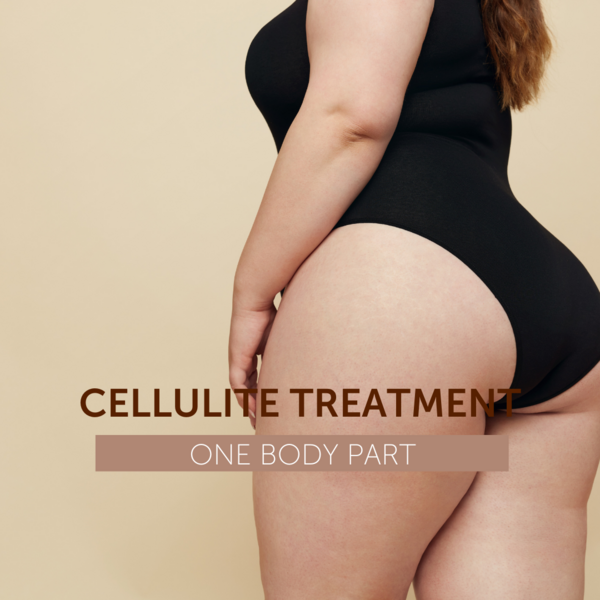 Vela Shape - Cellulite Treatment
