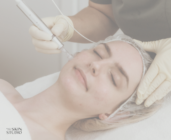 Advanced Skin Needling Package