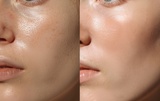 Skin Refinement Package w/Dr. Zaré