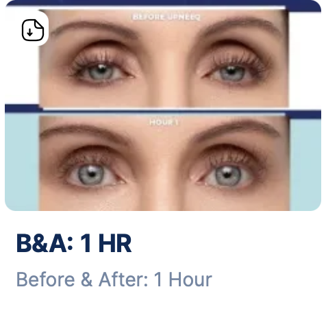 Upneeq Eye Drops 30 Vials