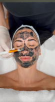 Carbon Laser Facial with LED