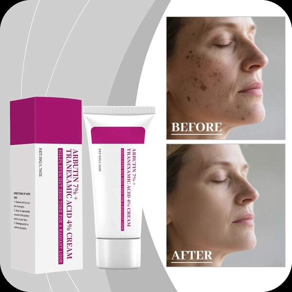 Arbutin 7% + TXA 4% treatment serum