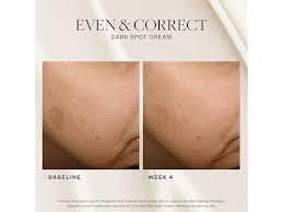 Even and Correct Dark Spot Cream