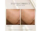 Even and Correct Dark Spot Cream