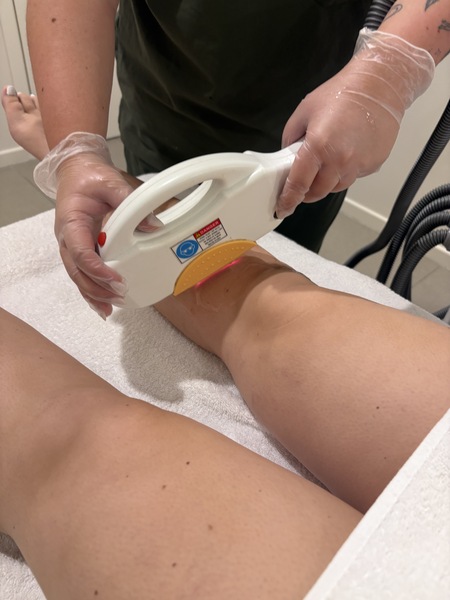 3 Pack - IPL Hair Removal UNDERARMS 50% OFF