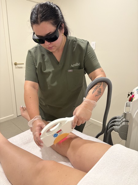 3 Pack - IPL Hair Removal CHIN 50% OFF