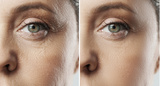 Peak Performance Skin Package w/Dr. Zaré